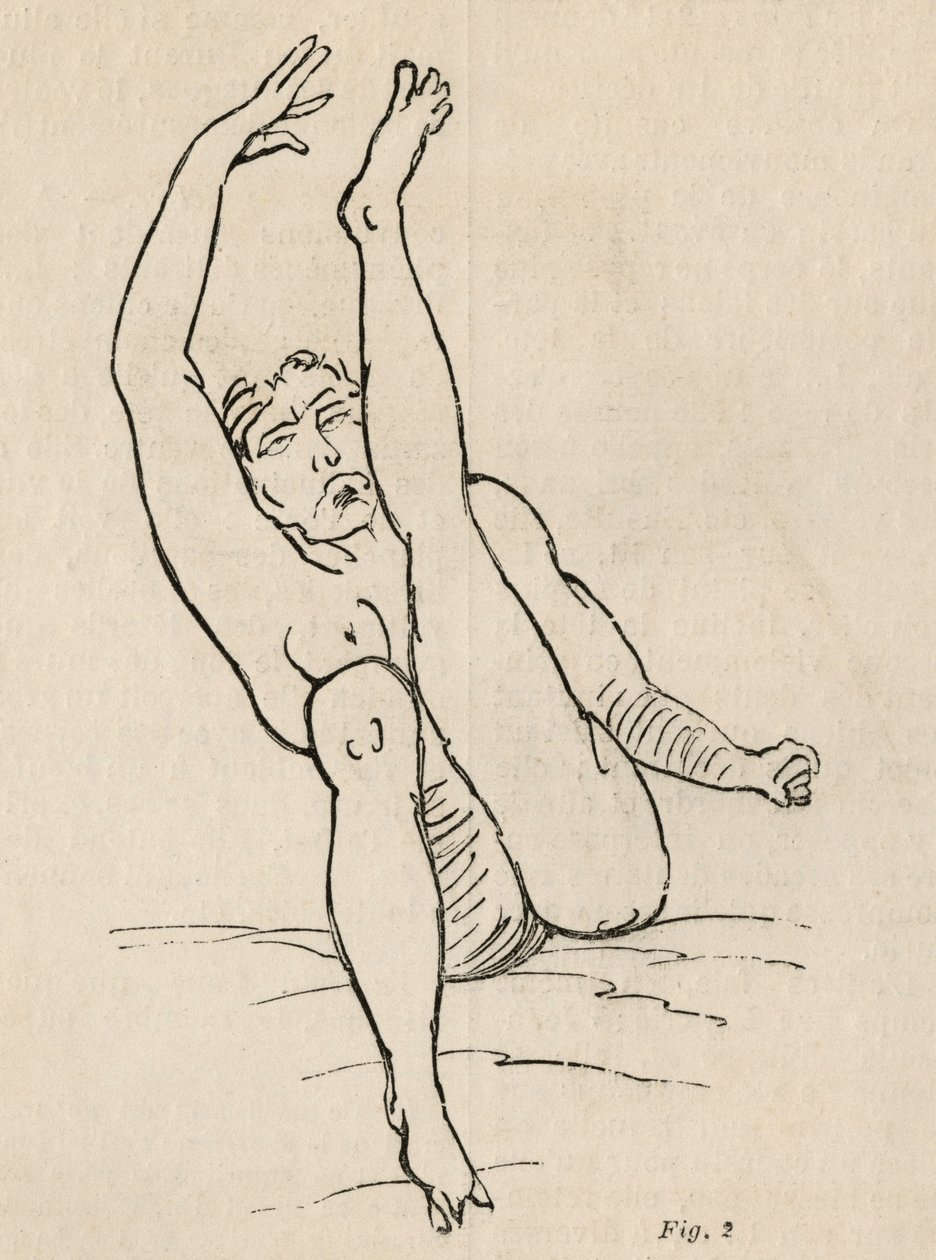 Hysterisk epilepsi, attack, vridningar, fig. 2 från 