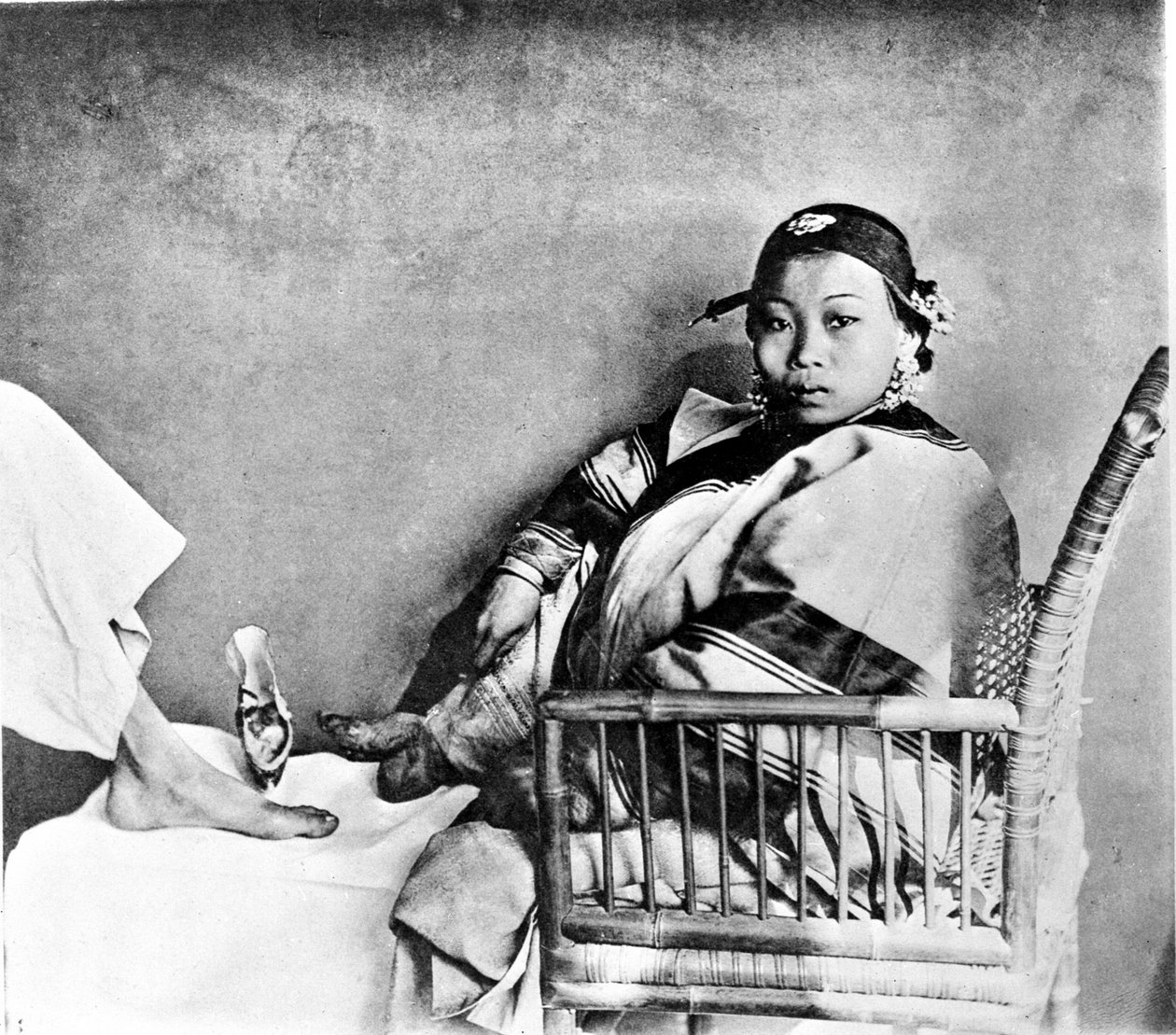 Kvinna som visar sin fot stympad genom att bära traditionella skor bredvid en europeisk fot (foto) av John Thomson
