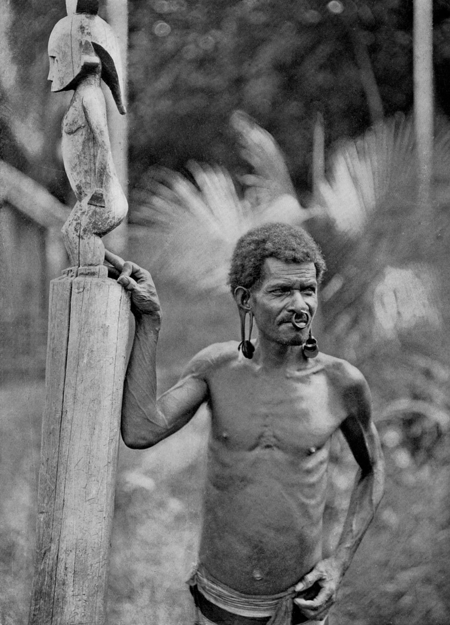 Missbildning av öronen, Salomonöarna, 1920. av John Watt Beattie