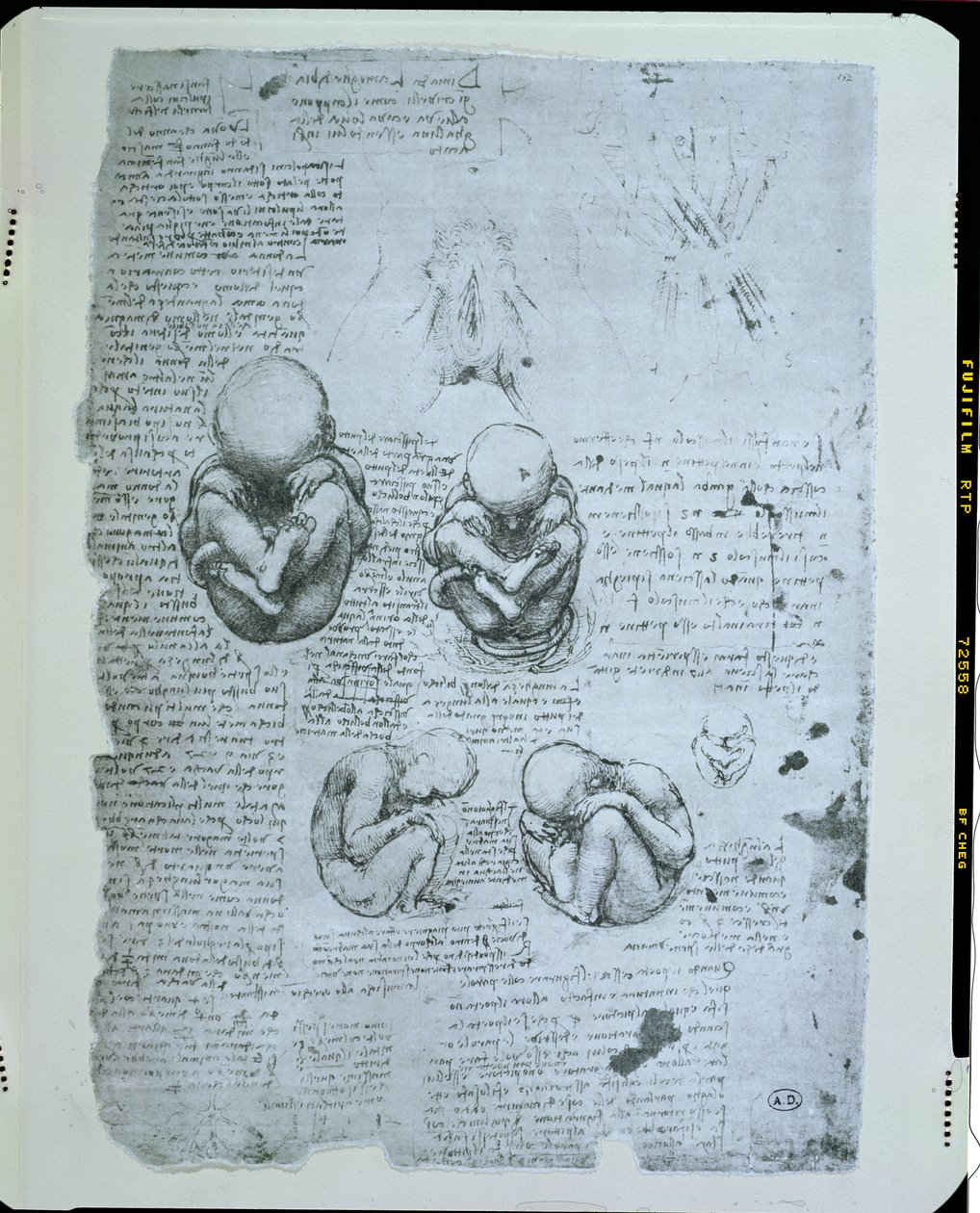 Fem vyer av ett foster i livmodern, faksimilkopia av Leonardo da Vinci