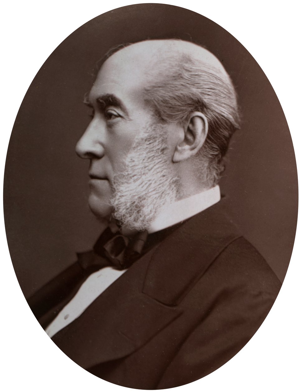 Sir William Fergusson, Bart, FRS, sergeant-kirurg till drottningen, 1877. av Lock and Whitfield