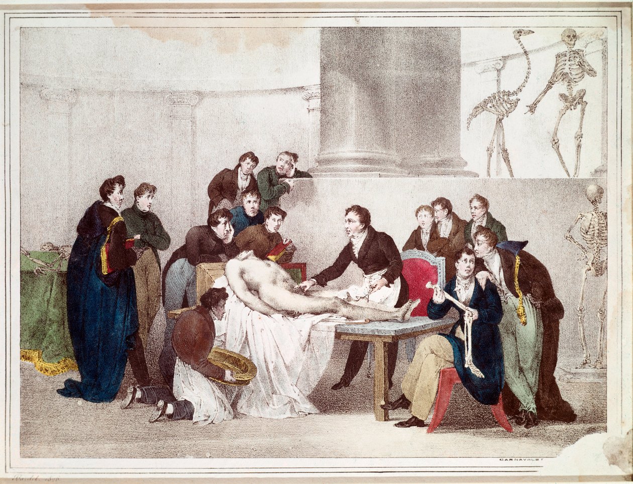 Anatomilektionen (litografi av Louis Thomas Bardel