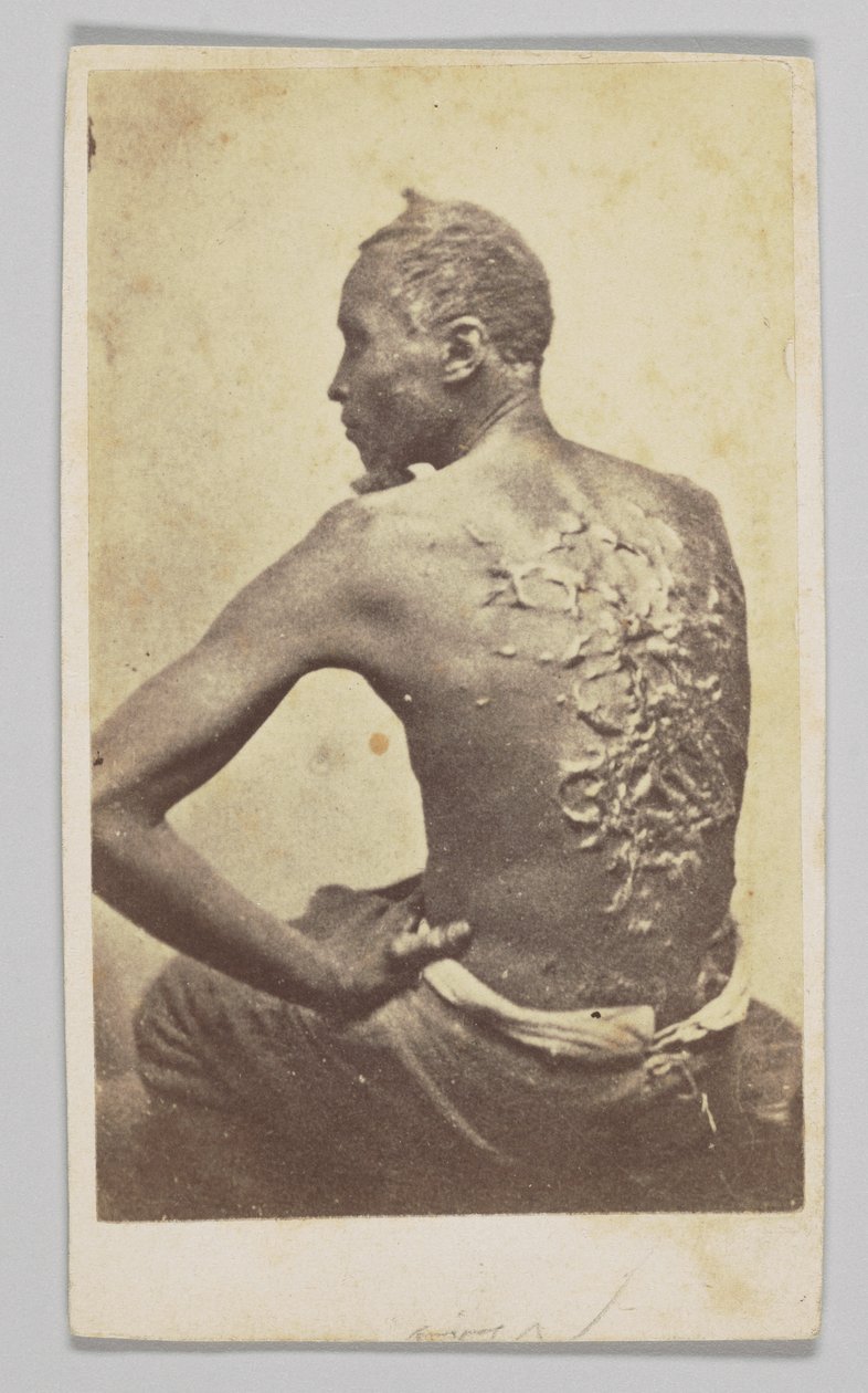 Gordon under medicinsk inspektion, 1863. av McPherson and Oliver