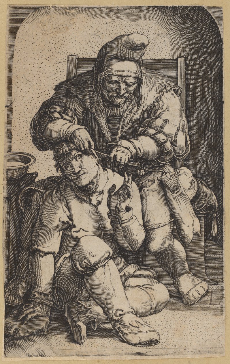 Kirurgen [omvänd kopia] av Netherlandish 16th Century, after Lucas van Leyden