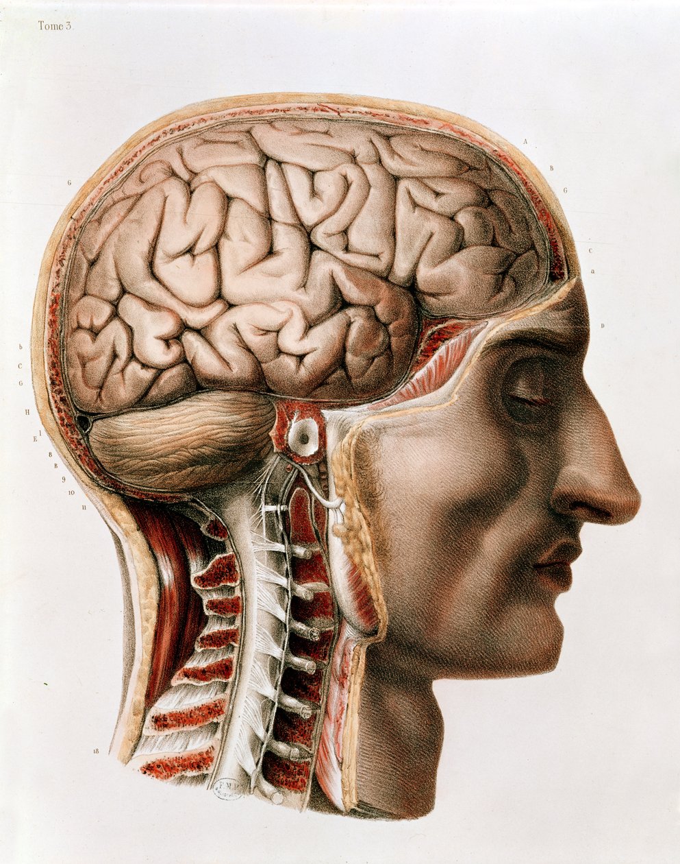 The Brain, tallrik från 