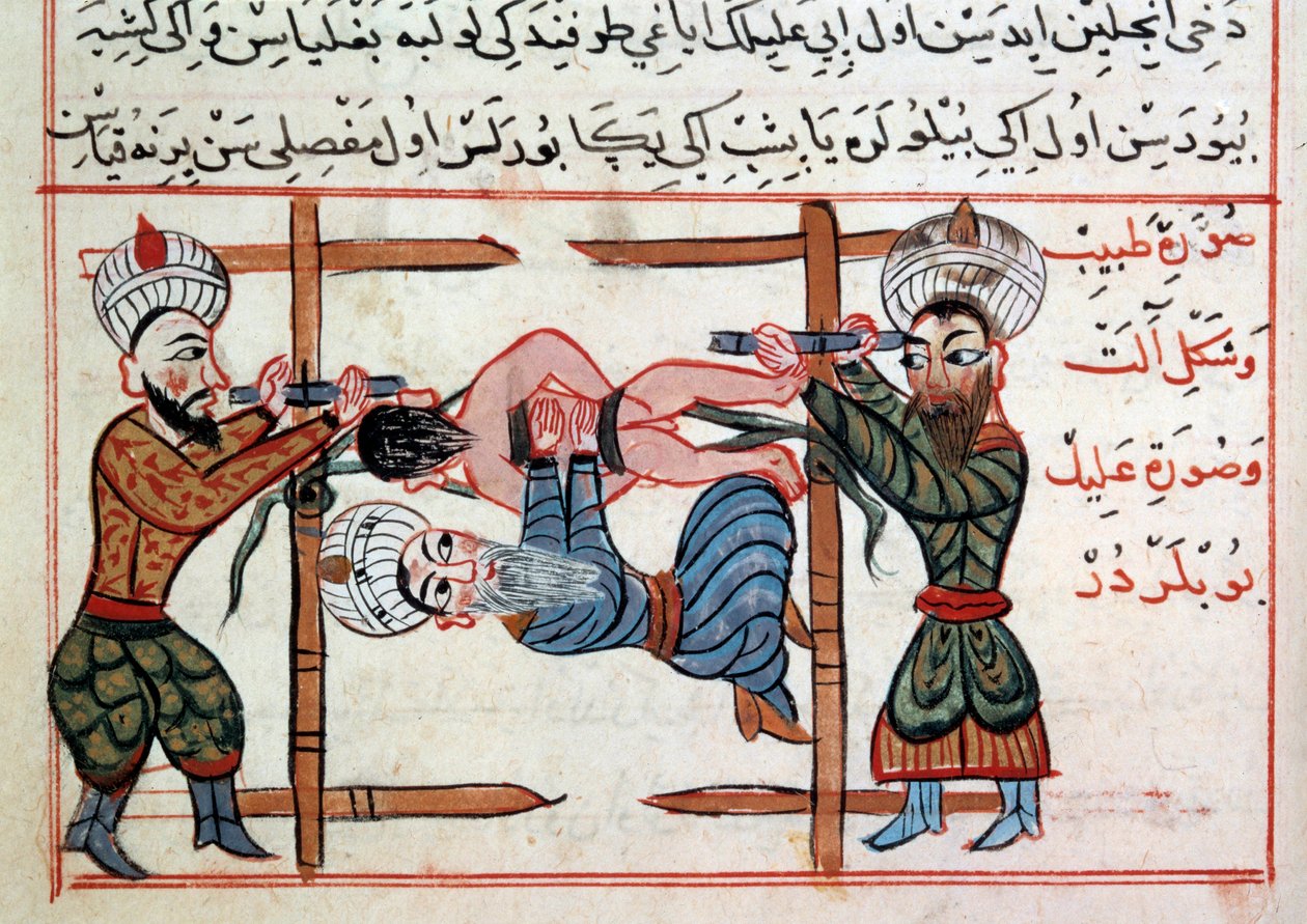 Minskning av en fraktur. Miniatyr från en behandling av turkisk medicin av Sharaf al-din av Ottoman School