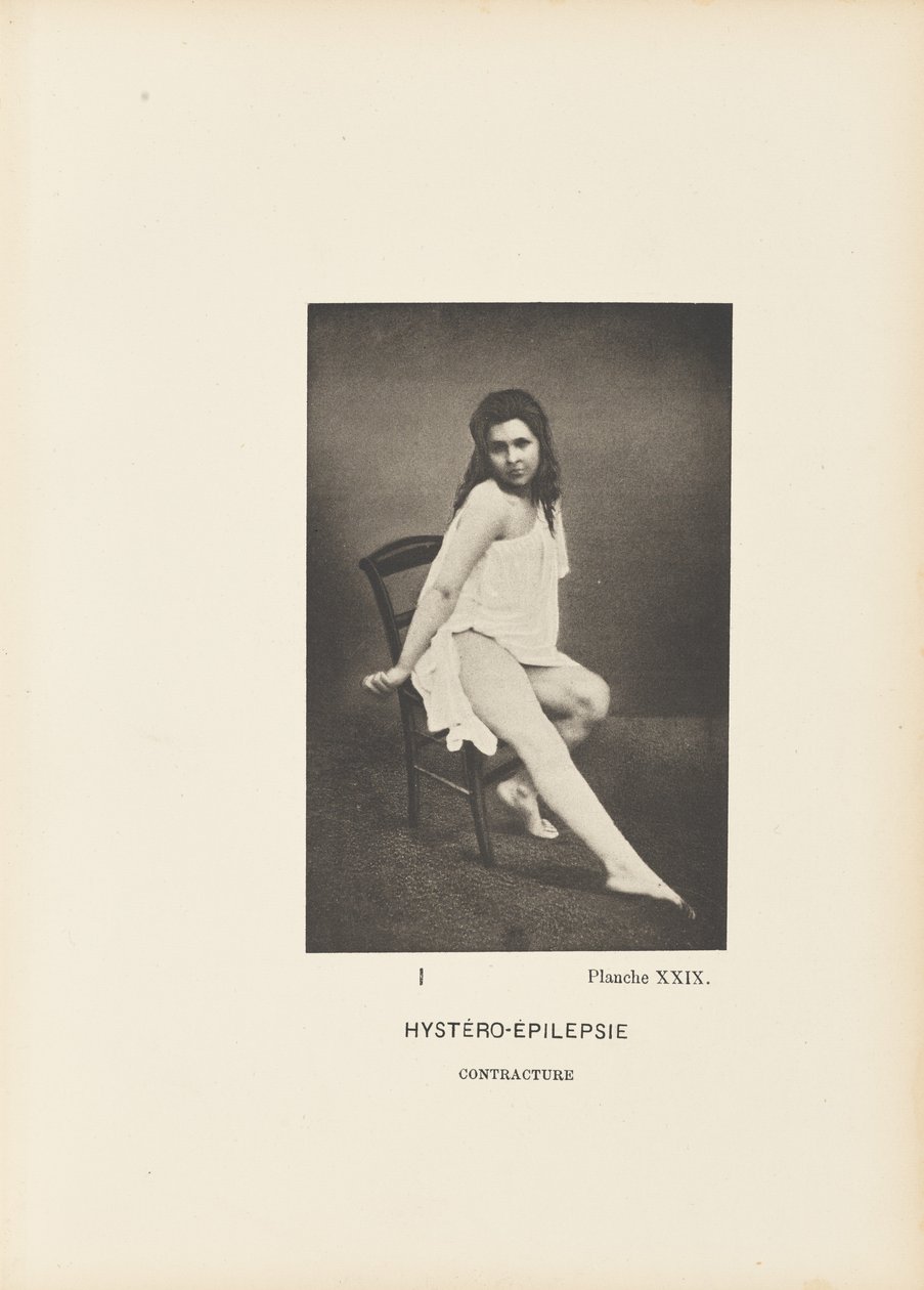 Hystero-epilepsi Kontraktur av Paul Marie Léon Regnard