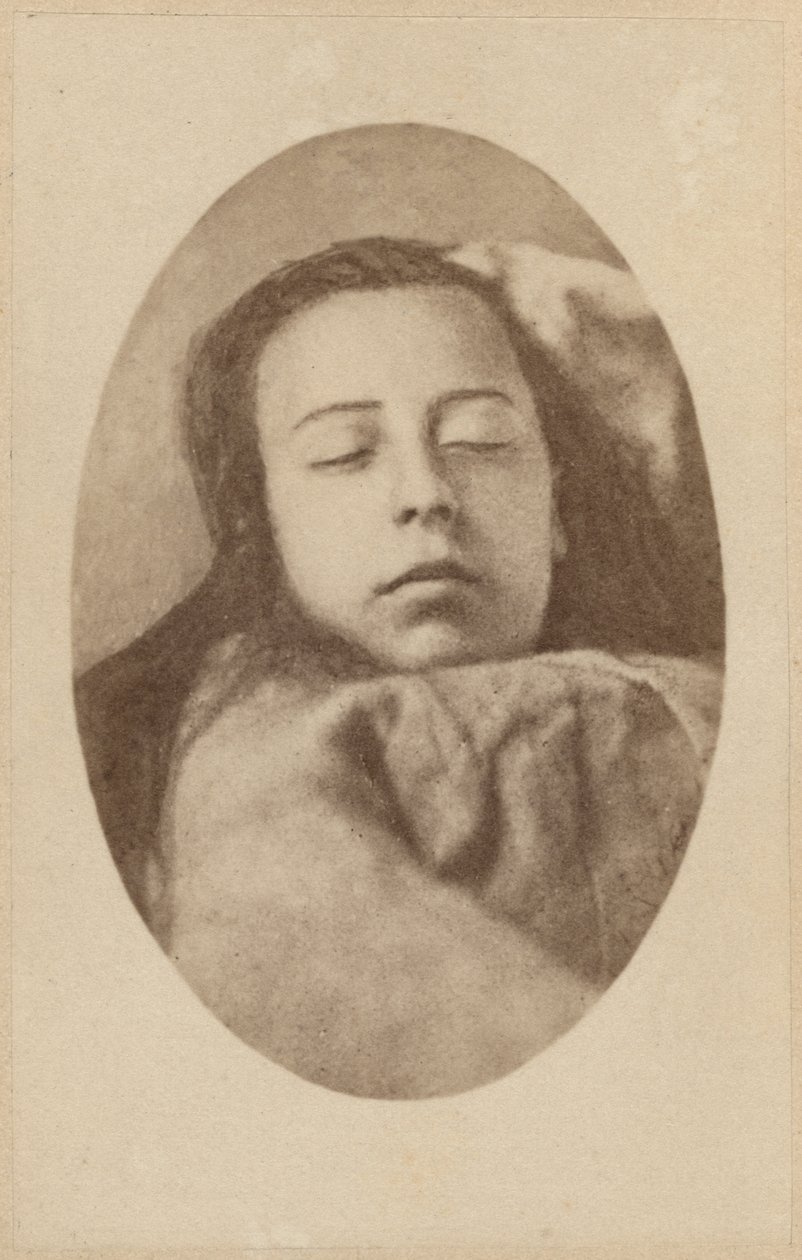 Hysteriattack, andra fasen, illustration från "Iconographie Photographique de La Salpetriere" av Bourneville et P. Regnard, platta III, Paris, 1876 (albumenprint) av Paul Regnard
