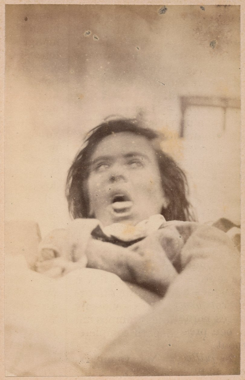 Hysterisk epilepsi, hallucinationer, ångest, tallrik XXIX från 