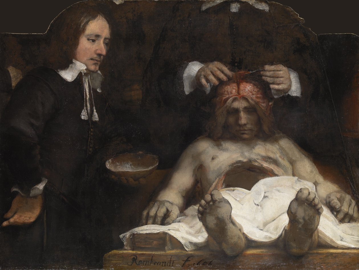 Dr Jan Deymans anatomilektion, 1656 av Rembrandt van Rijn