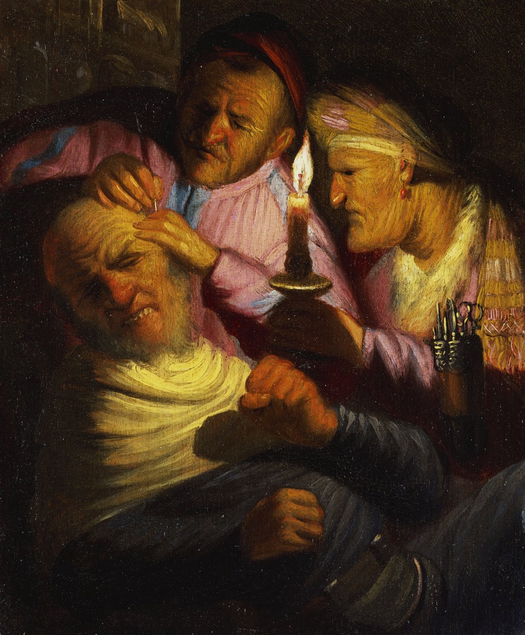 The Sense of Touch: The Stone Operation av Rembrandt van Rijn