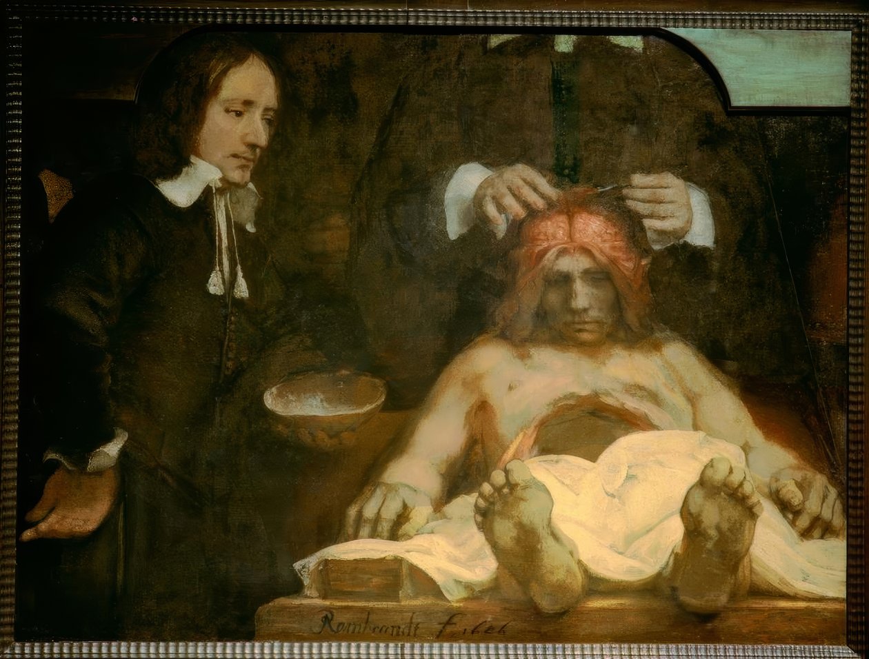 Anatomin hos Dr. Johan Deijman av Rembrandt van Rijn