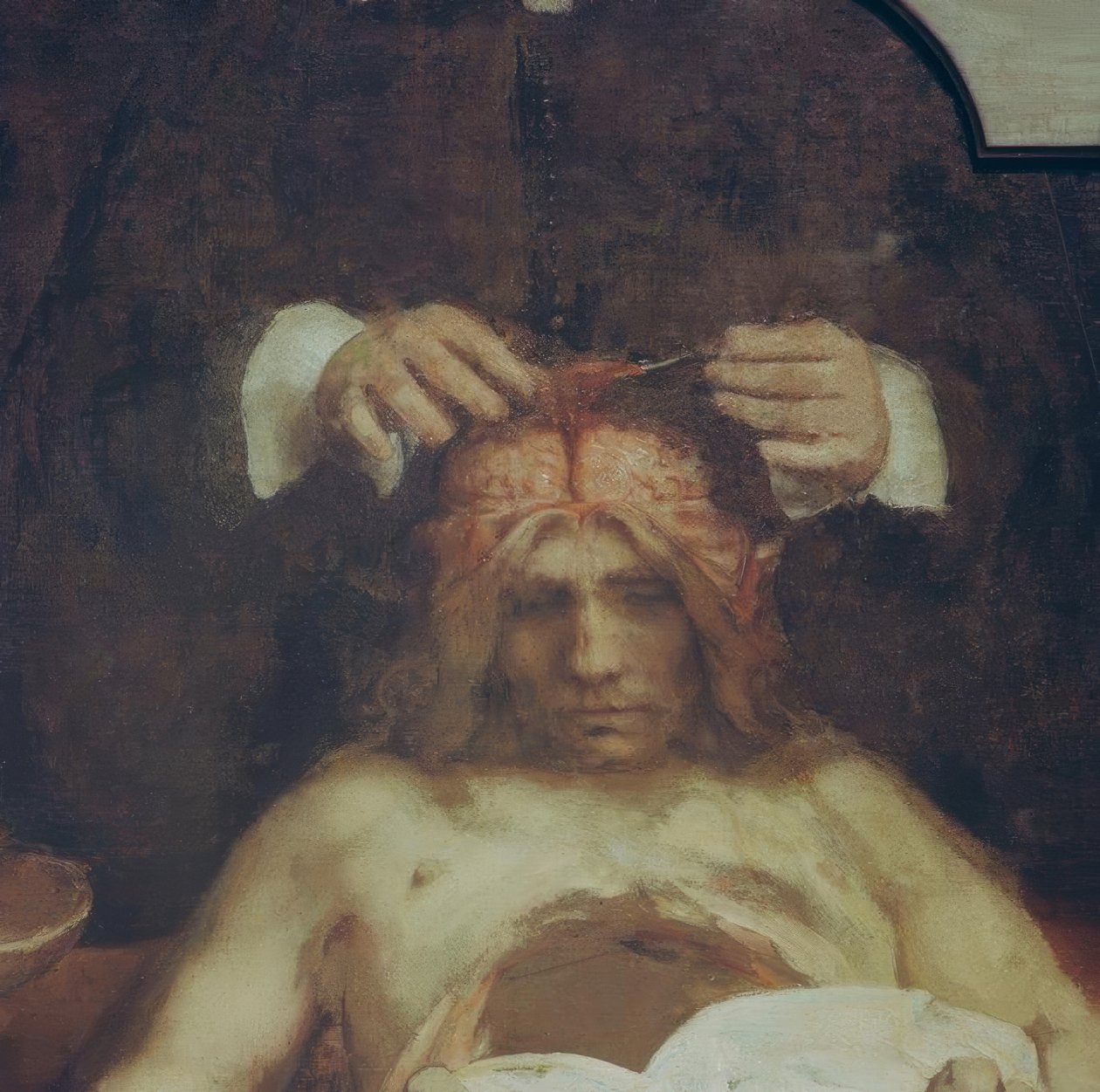 Anatomin hos Dr. Johan Deijman av Rembrandt van Rijn