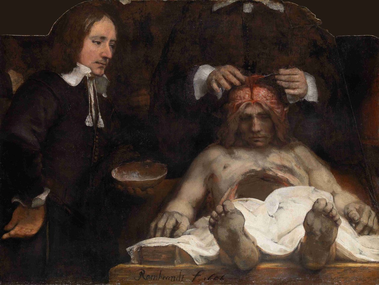 Dr Jan Deijmans anatomilektion, 1656 av Rembrandt van Rijn