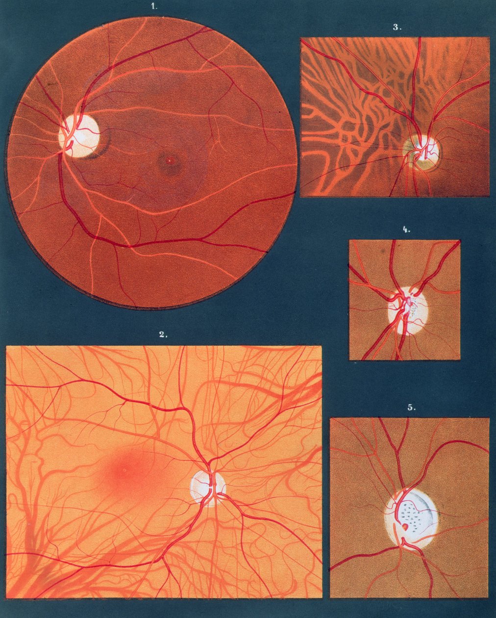 Ögat sett genom ett mikroskop, från Atlas of Ophthalmoscopy, publicerad i Paris, 1870 (chromolitho) av Richard Liebreich
