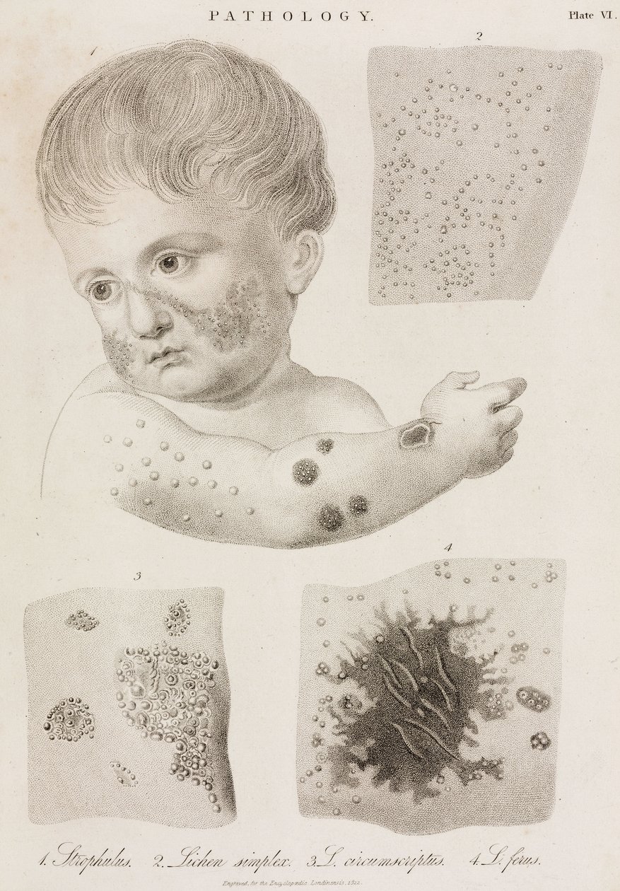 Dermatologi Typer av hudsjukdomar av John Pardon