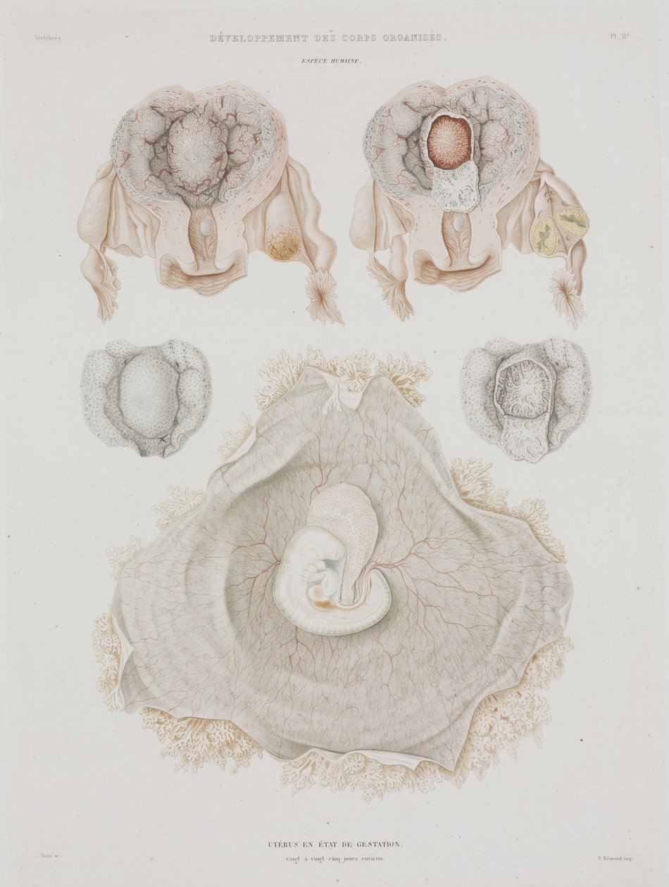 Gynekologi Mänsklig livmoder med embryo, c 1847-1859 av John Pardon
