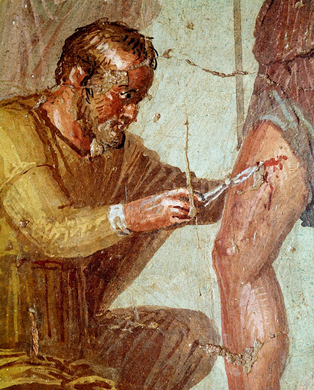 Sårade Aeneas behandlas av Iapyx med hjälp av Venus (fresk, 54-79 e.Kr.) av Roman