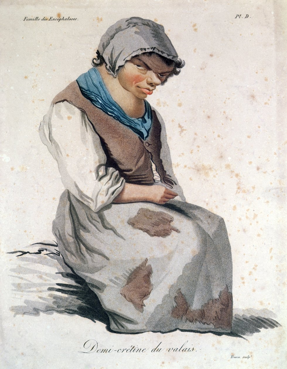 Cretin från Valais (färggravyr) av Salvadore Tresca