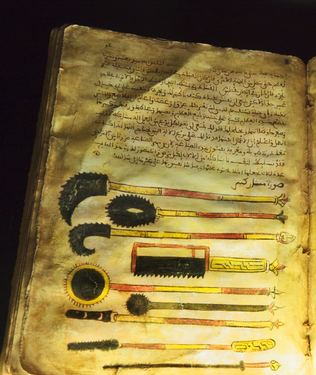 Illustration från "On Surgery and Instruments" eller "Al-Zahrawi" av Abu al-Qasim al-Zahrawi. av Unbekannt Unbekannt