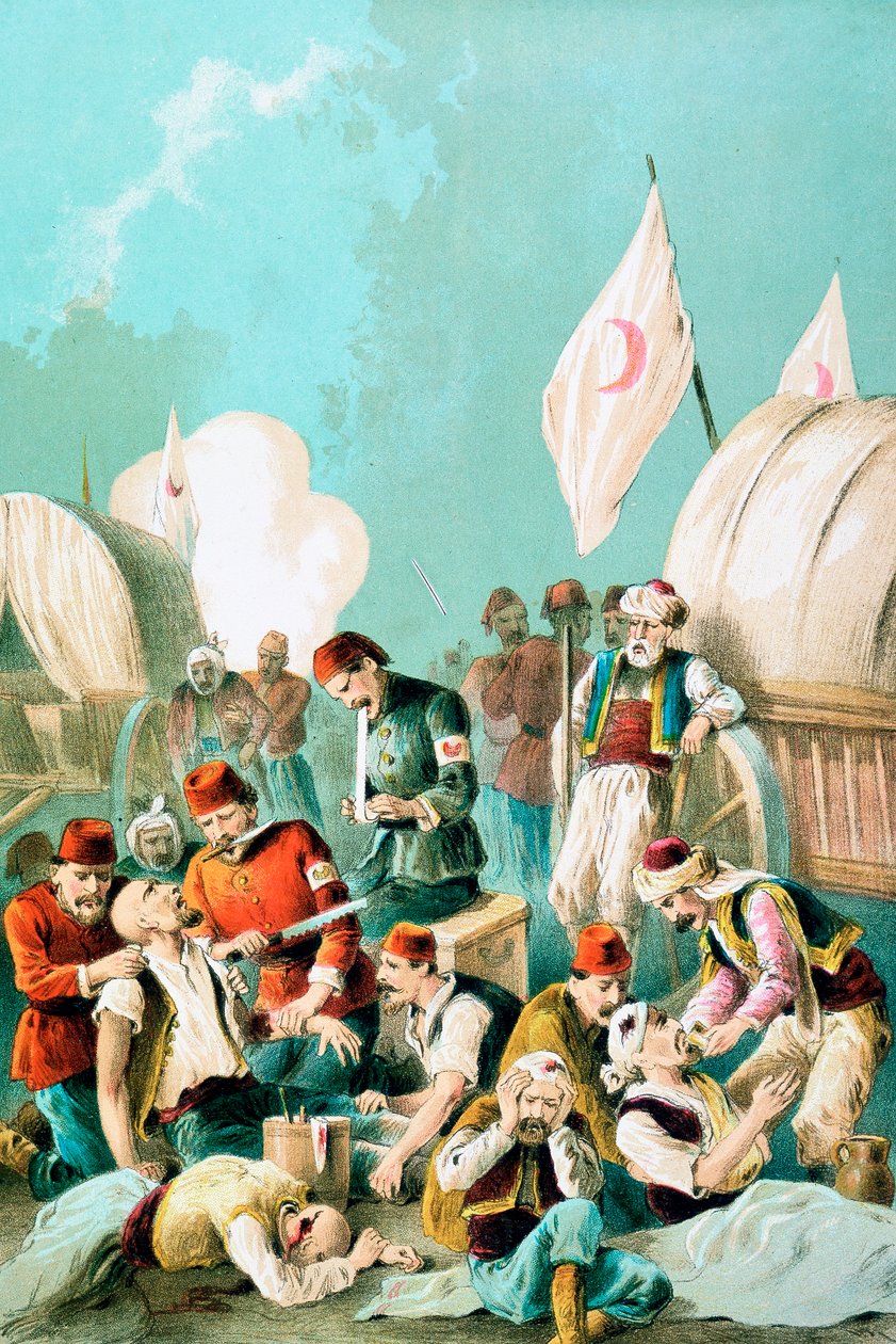 Arm amputeras utan bedövning, Rysk-Turkiska kriget, 1877 av Unbekannt