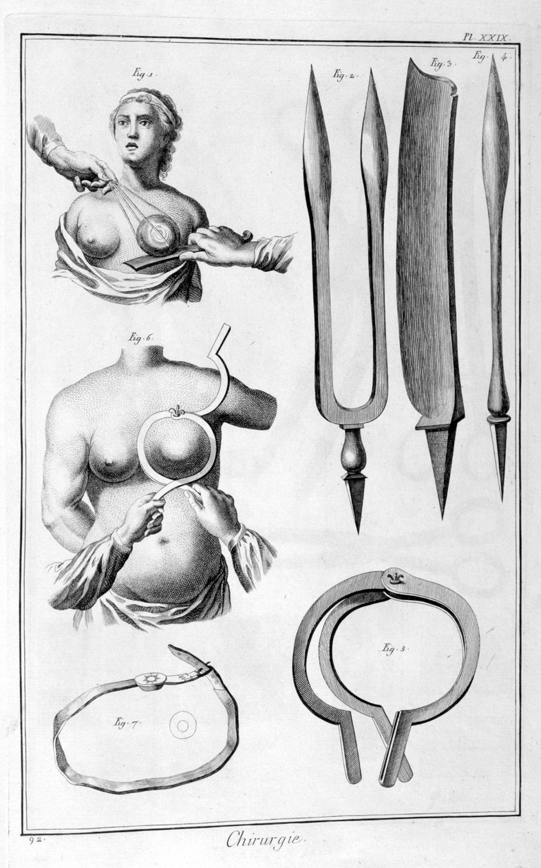Bröstkirurgi, 1751-1777 av Unbekannt