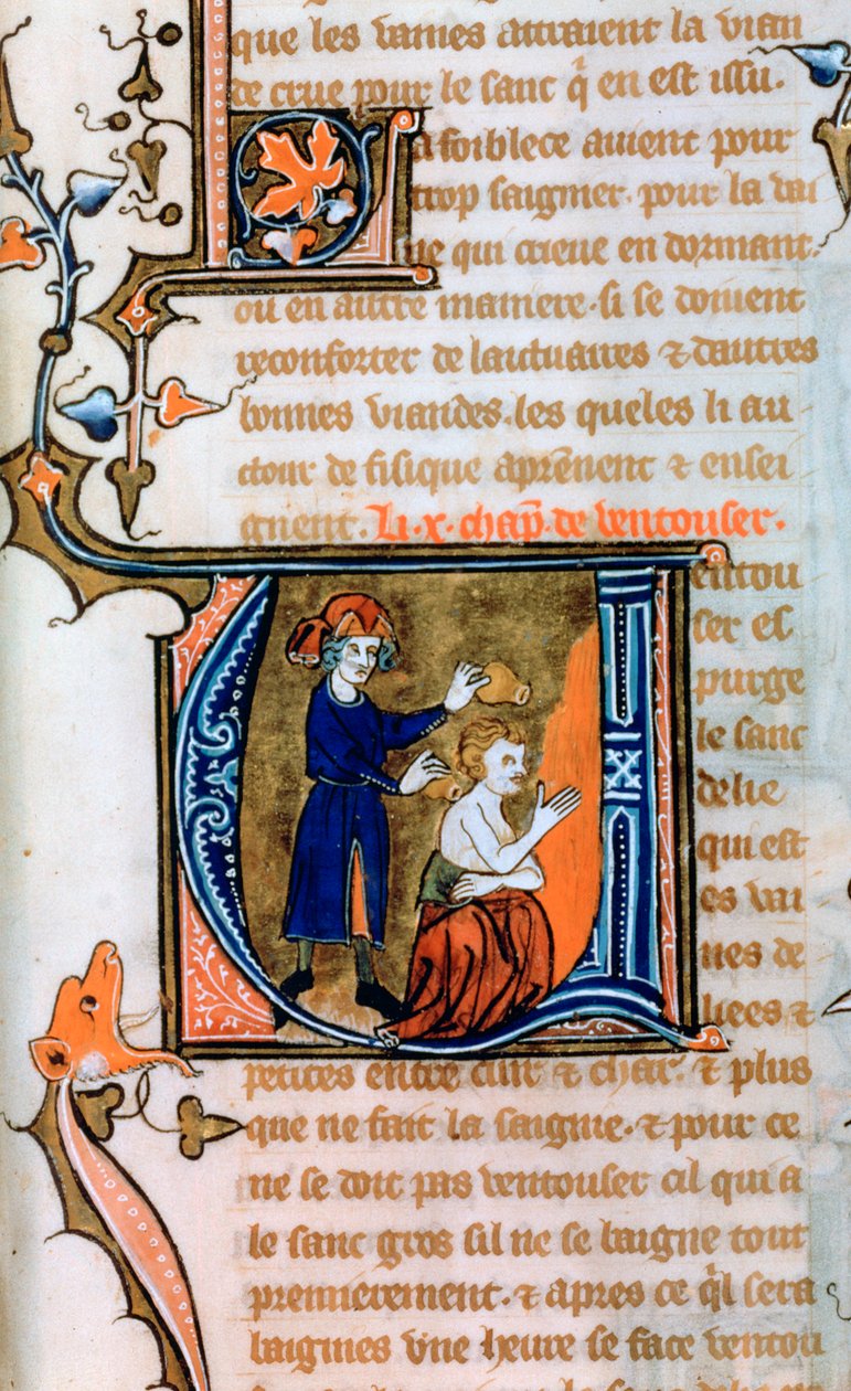 Koppning, 1300-talet av Unbekannt