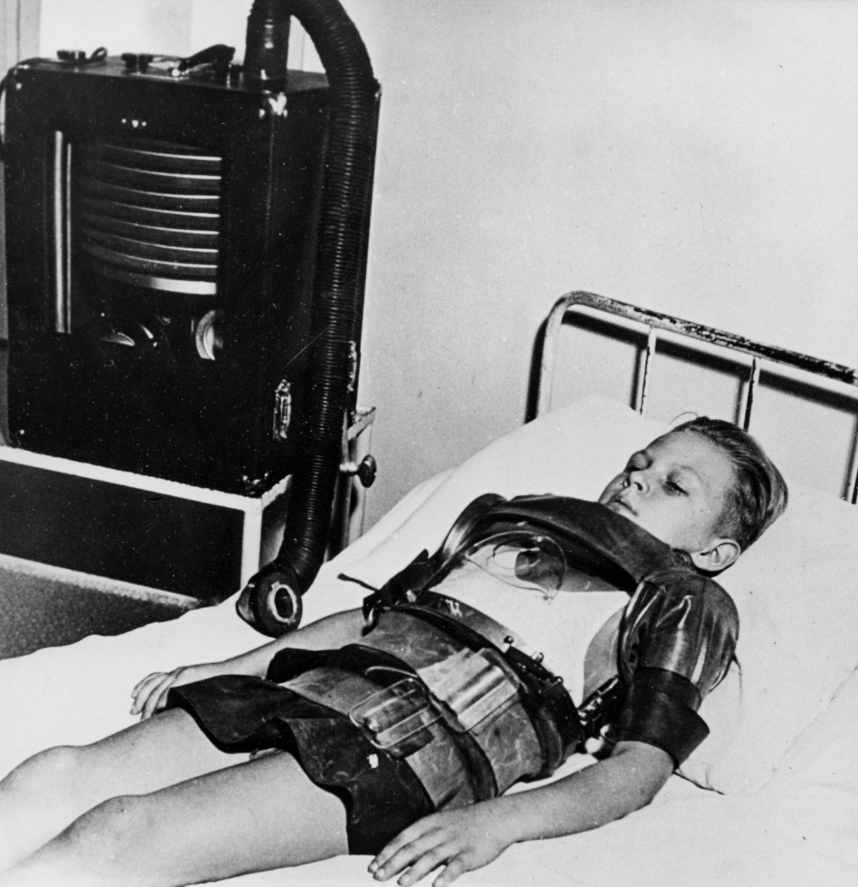 Elva år gammal pojke i en järnlunga, Beaujon Hospital, Paris, c1947-1951 av Unbekannt