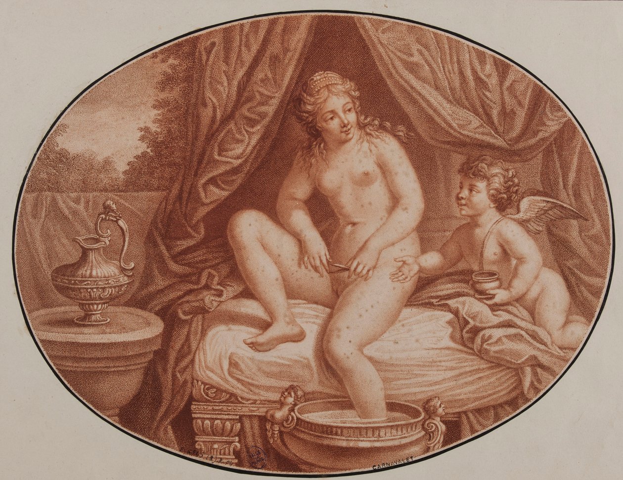 Epilering, 1700-talet. av Unbekannt