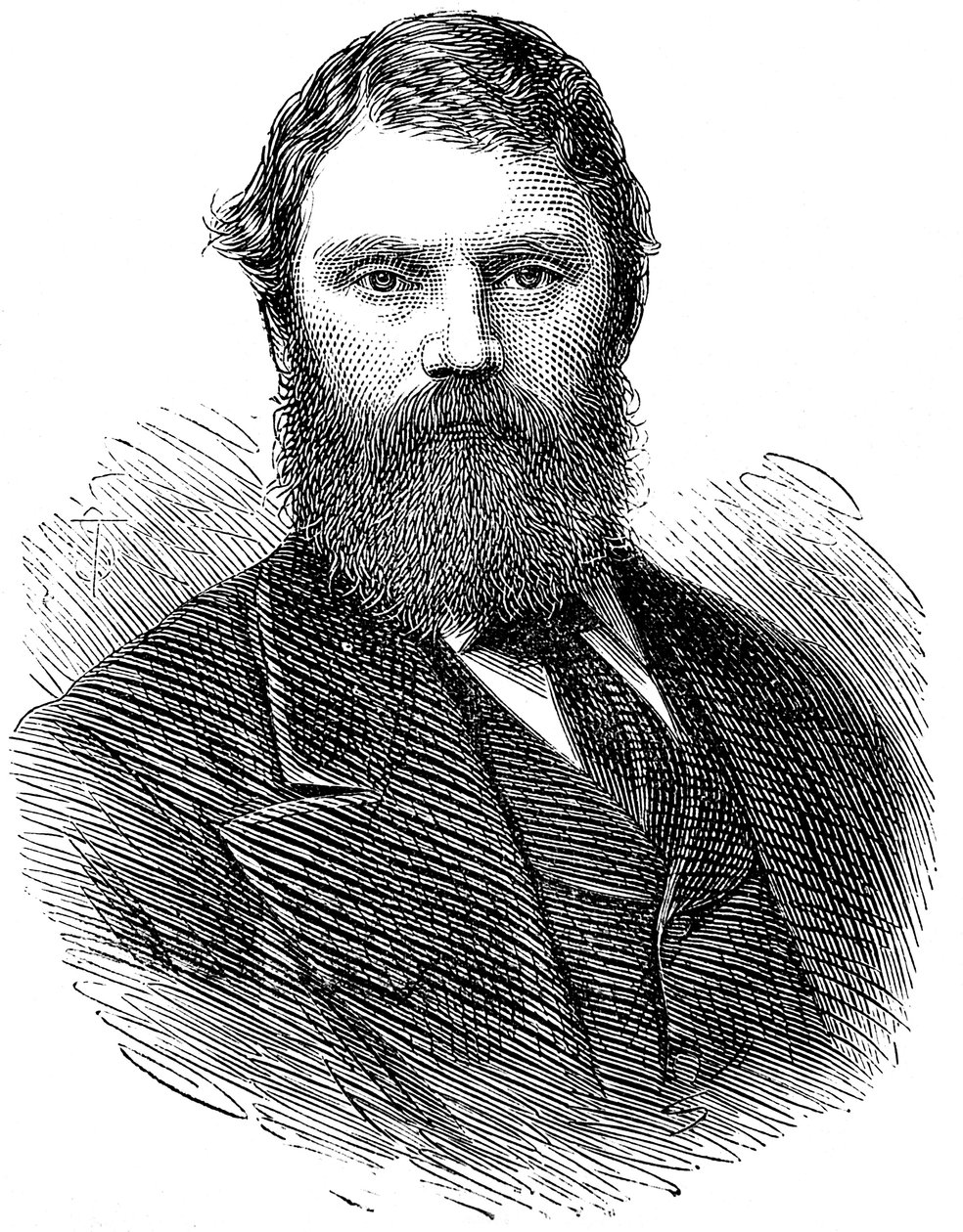 Francis Edmund Anstie 1833-1874, engelsk läkare, 1874 av Unbekannt