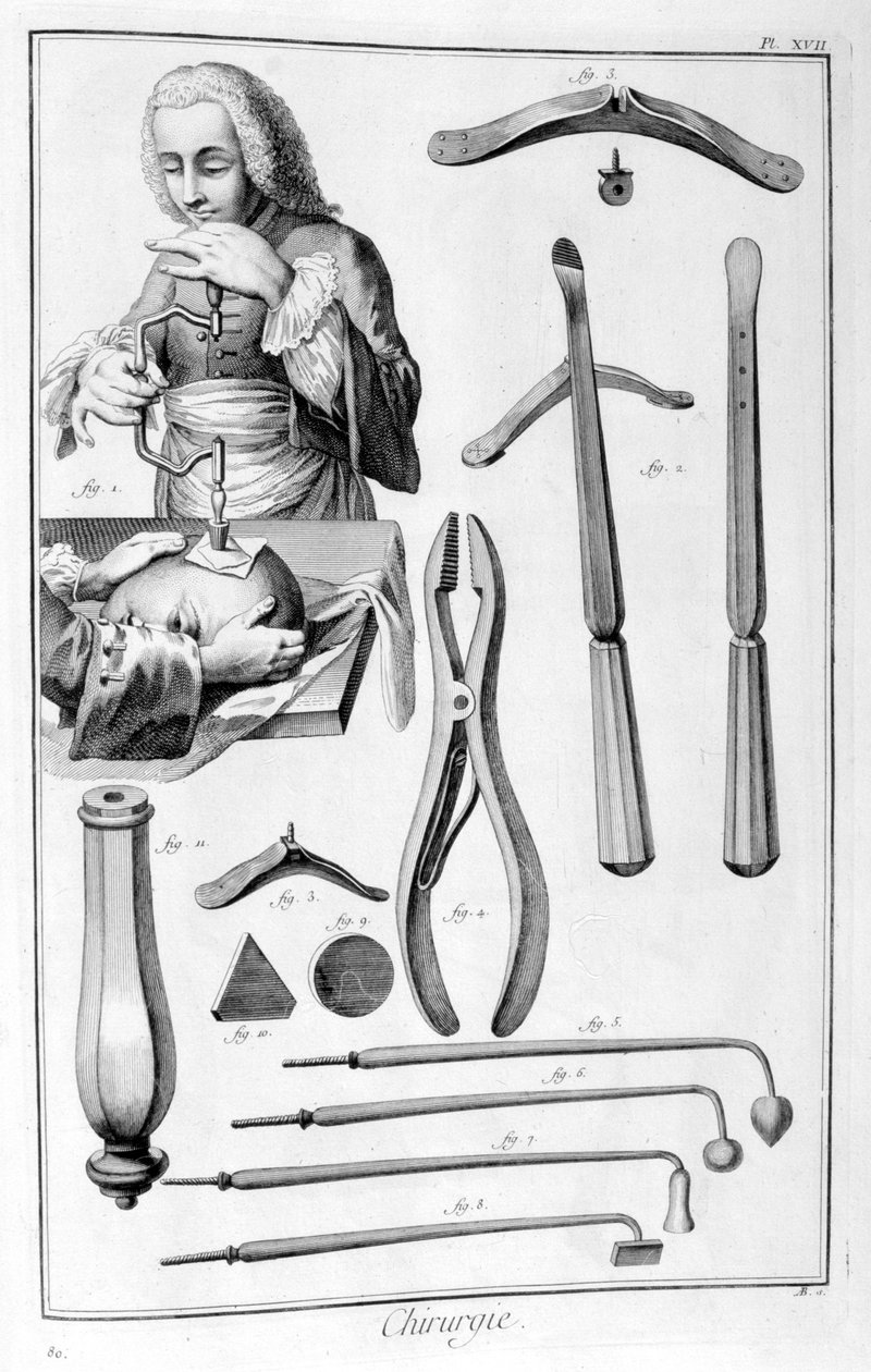 Huvudkirurgi, 1751-1777 av Unbekannt
