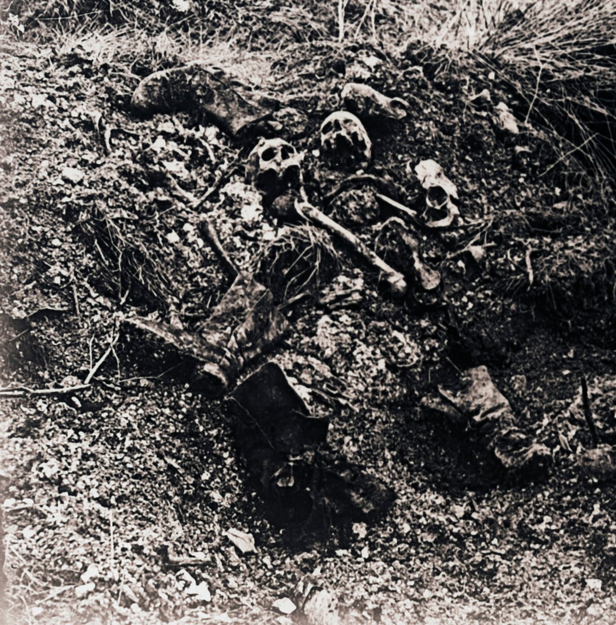 Mänskliga kvarlevor, c1914-c1918 av Unbekannt