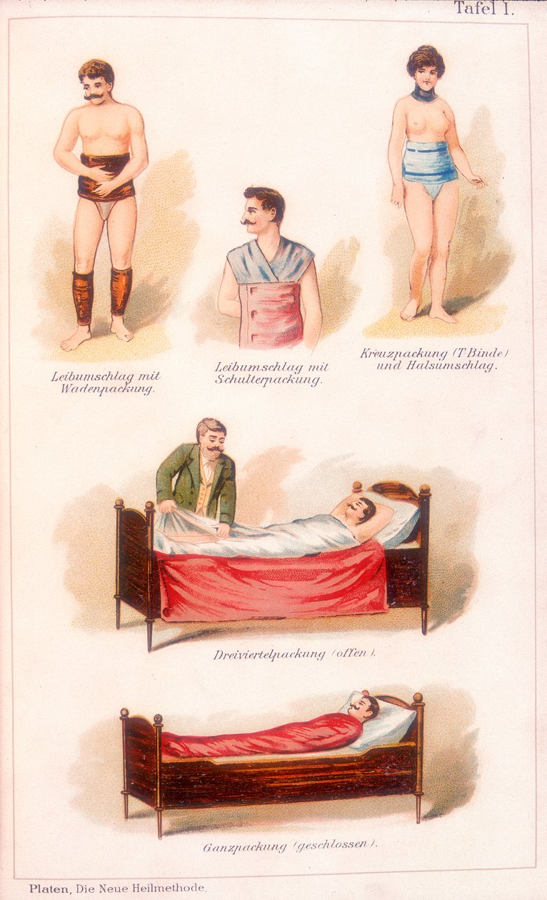 Hydroterapibehandlingar, c1902 av Unbekannt