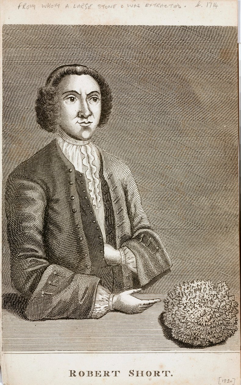 Robert Short, medicinsk nyfikenhet, ca 1750-talet av Unbekannt