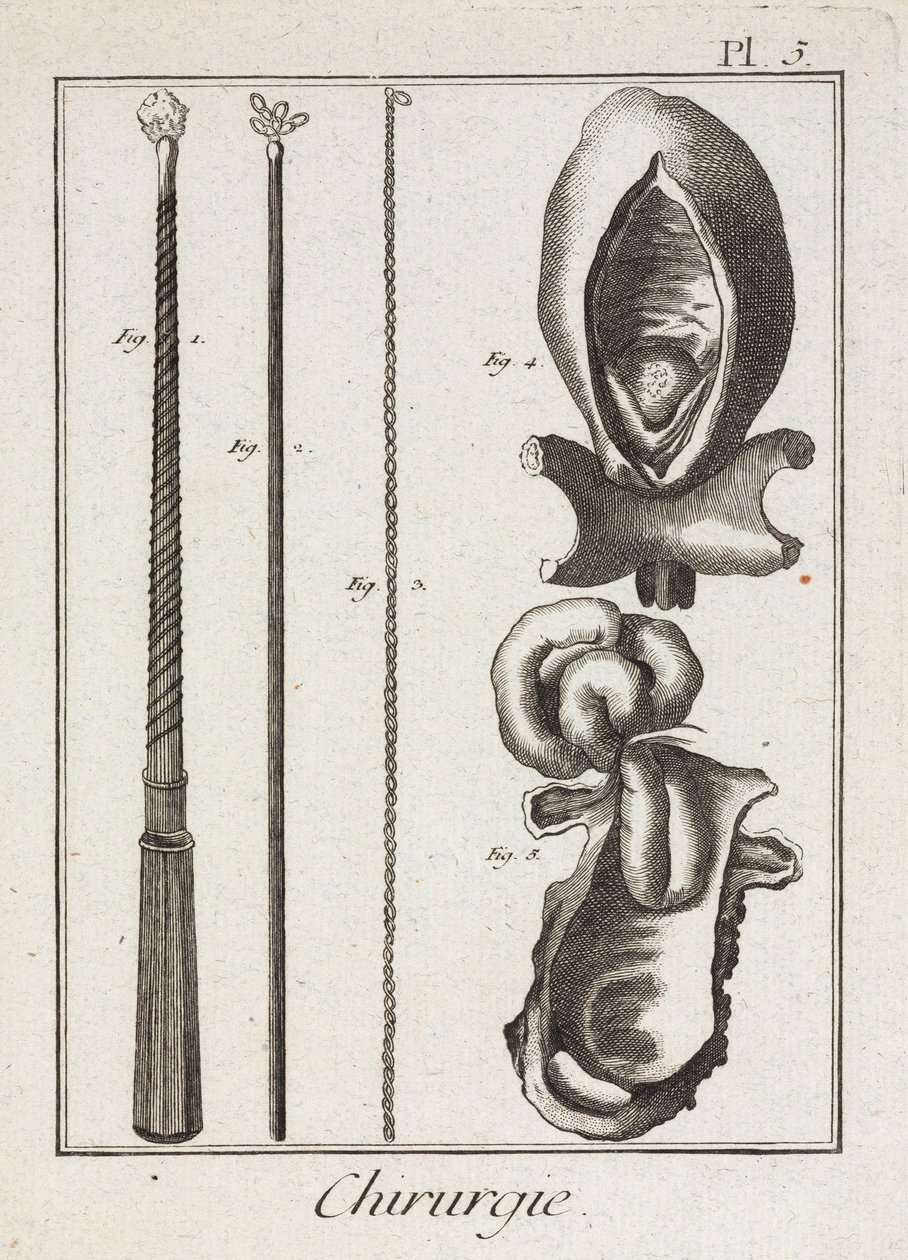 Utrustning, tidigmoderna kirurgiska instrument och diagram över kroppsdelar av Unbekannt