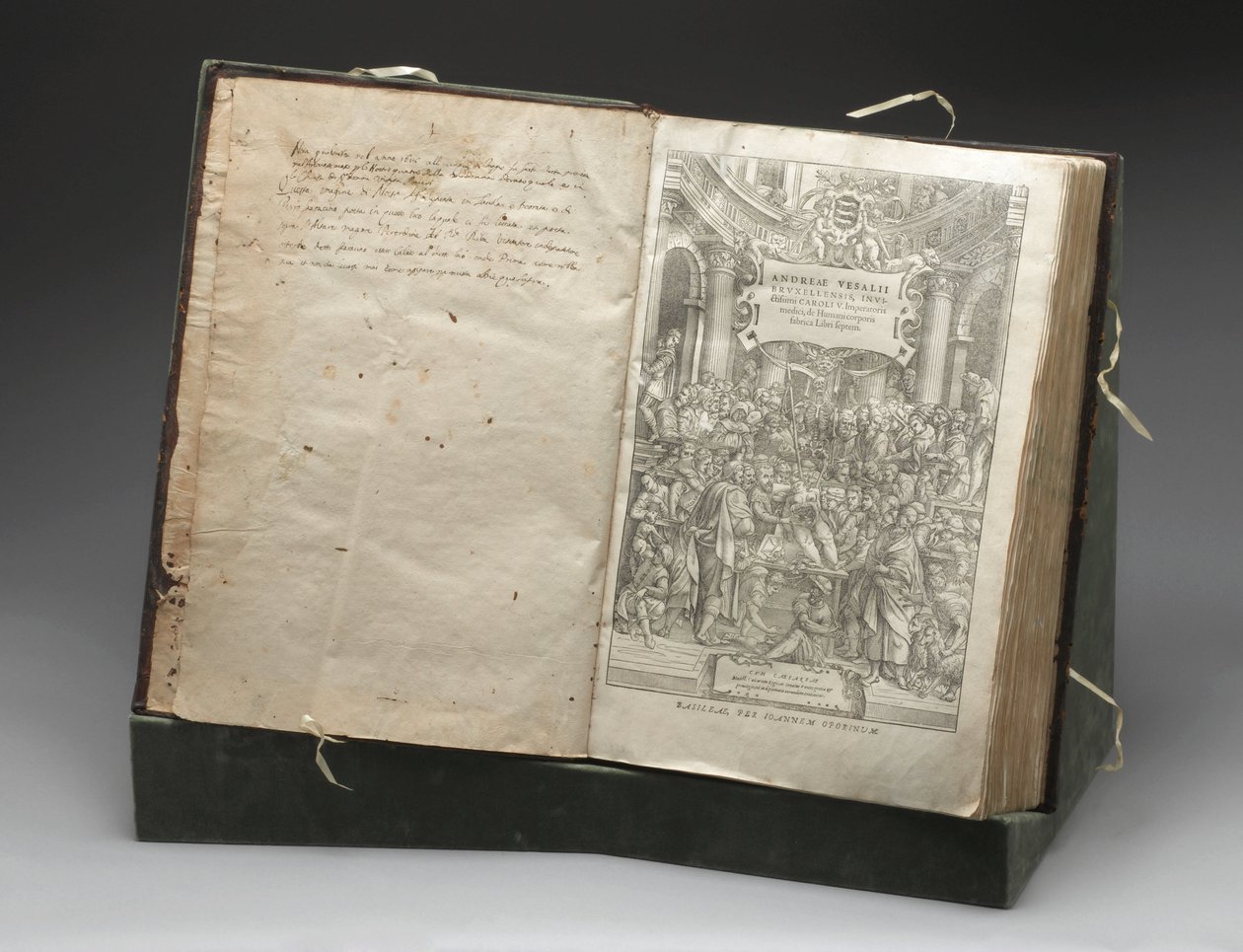 Patologi, Dissektioner Träsnitt av Andreas Vesalius som dissekerar ett kadaver av Unbekannt