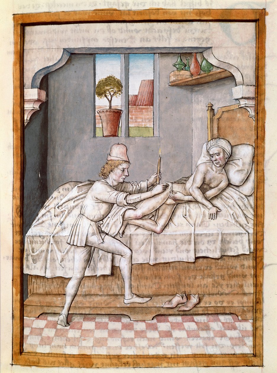En läkare behandlar en miniatyrpatient från en tysk översättning av fablerna om "Kalila (Calila) och Dimna" av Bidpai. (ms. 1389, fol. 23) omkring 1480 Chantilly, museum Conde av Unknown artist