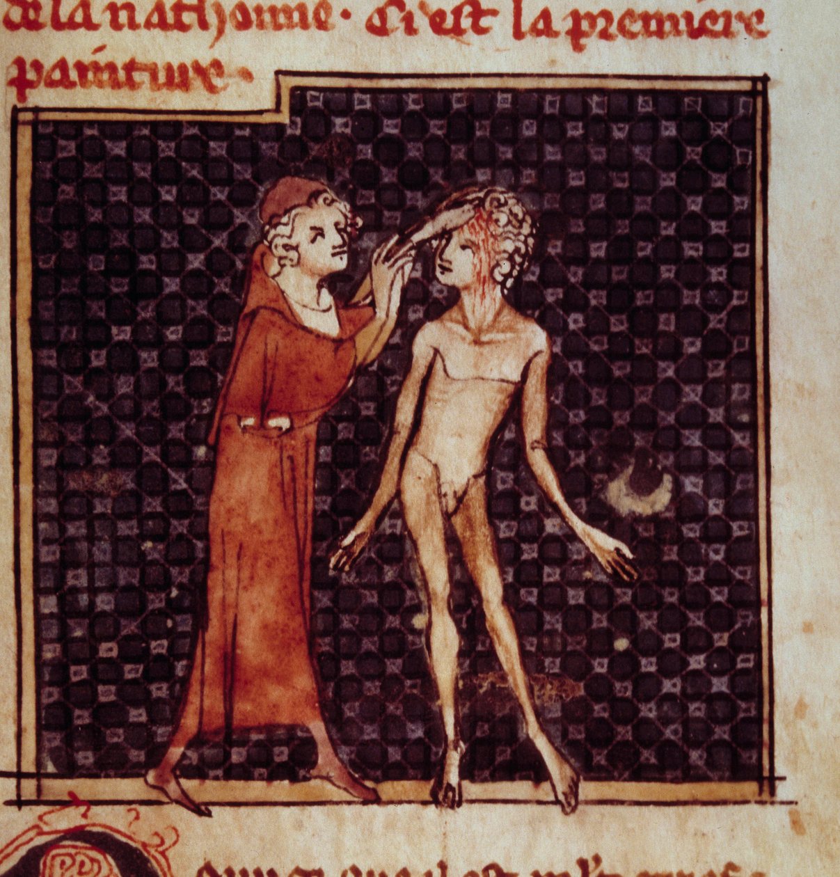 Anatomisk figur: Kirurgen snittar en patients panna. Miniatyr från manuskriptet "" Surgery" (Folio 8) skriven av Henri de Mondeville (kirurg hos Philippe Le Bel professor i anatomi) av Unknown artist
