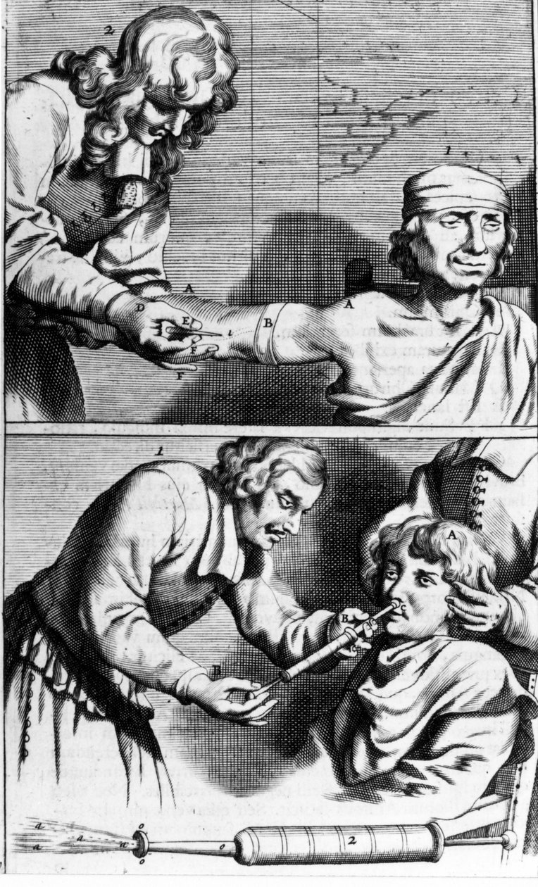 Blödning och näsdusch av Johannes Sculpteti "" Armamentarium Surgery"" Amsterdam 1672 av Unknown artist