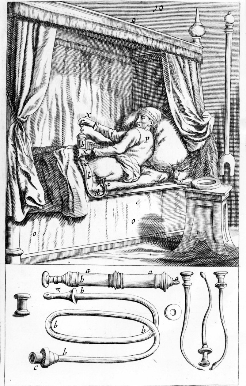Clystère (för lavemang) av Johannes Sculptetus "" Armamentarium Surgical"". Venedig 1665 av Unknown artist