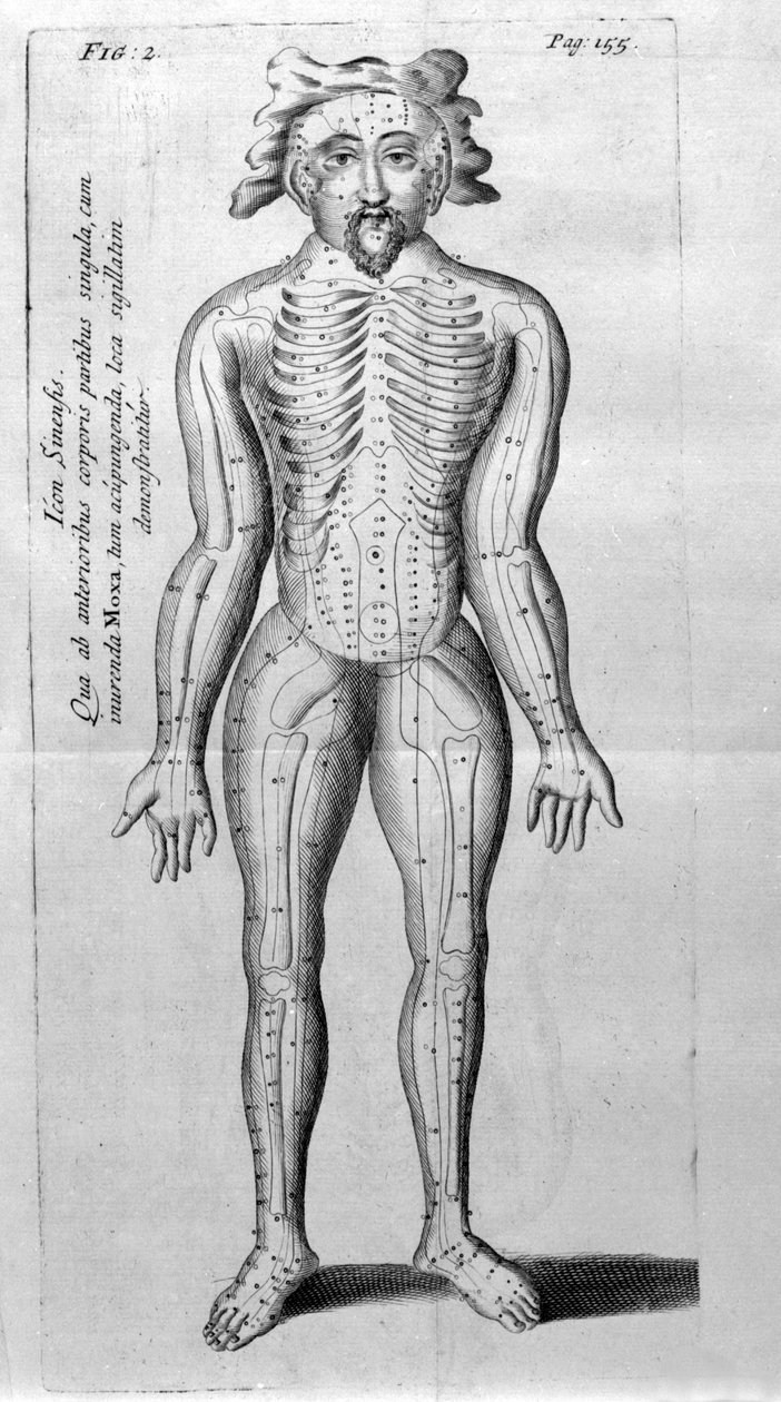 De Acupunctura av W.Ten Rhijn. London 1683. Första västerländska text som handlar om akupunktur. av Unknown artist