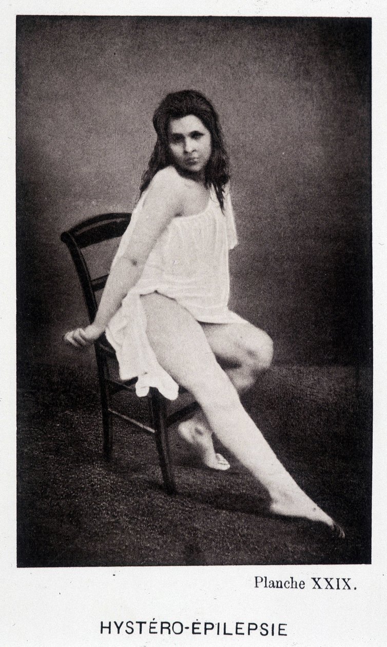 Hystero Epilepsie - Contracture in "" Photographic iconography of the Salpétrière: service of Mr. Charcot" av Paul Regnard och Bourneville av Unknown artist
