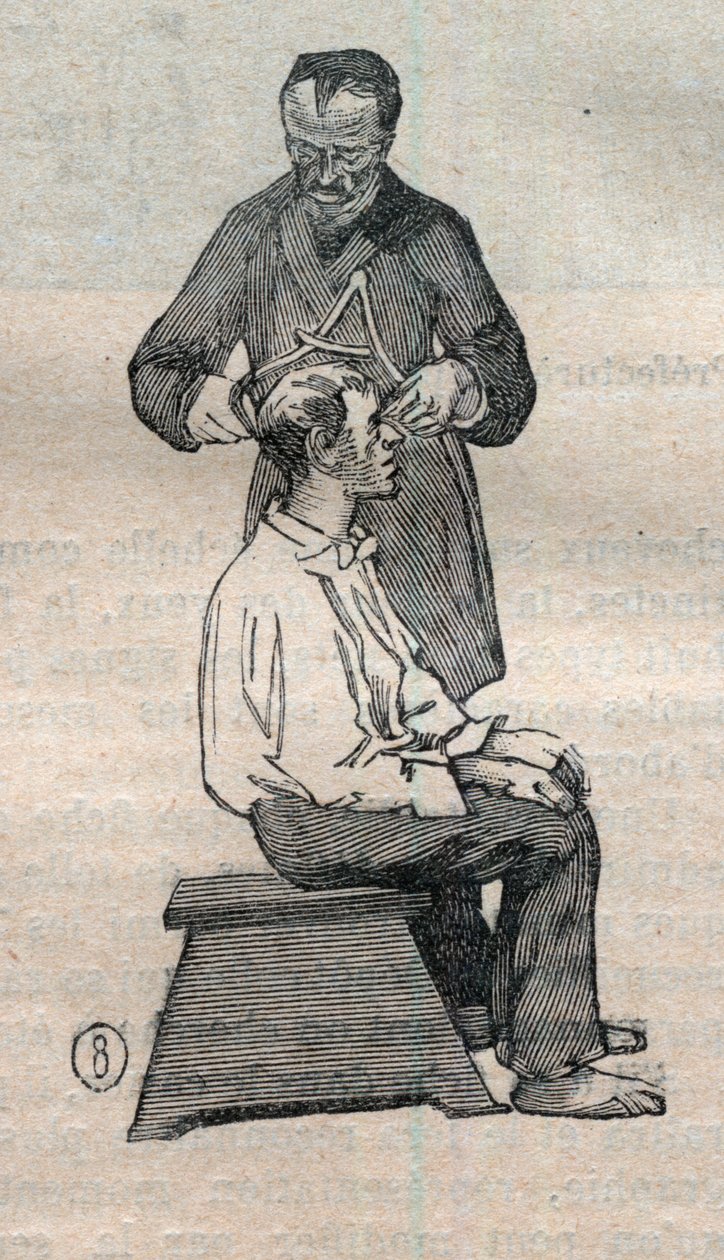 Rättslig antropometri eller bertillonnage, metod av Alphonse Bertillon (1853-1914): mätning av den tvärgående diametern på skallen - Gravyr i "" La Science francaise" av Unknown artist