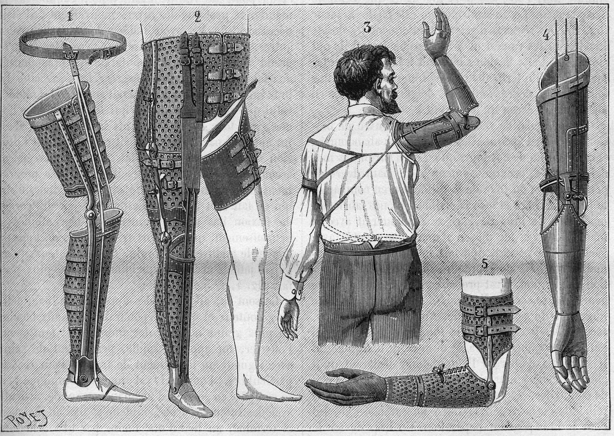 Modern apparat för amputering. 1) konstgjorda ben med bälte, 2) apparat för dearticules låret, 3 och 4 konstgjorda armar uppfunna och byggda av M.L Matthieu för framlidne Roger, 5) konstgjord arm med hand, tumme och pekfinger. i "La nature" från 1888. av Unknown artist