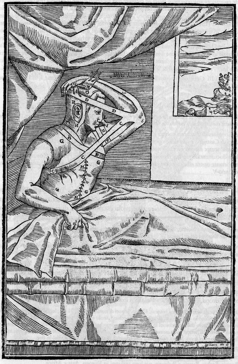 Näsoperation: Rekonstruktionskirurgi på näsan i ”De curtorum chirurgia per insitionem””. Venedig av Unknown artist