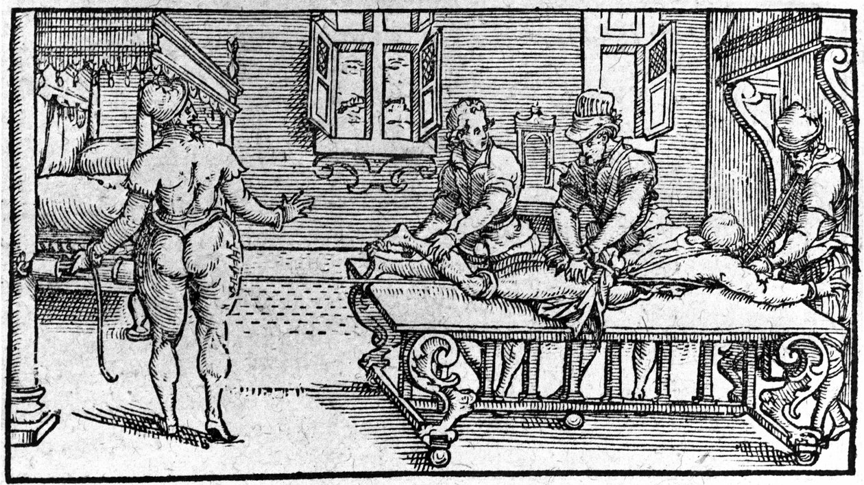 Reduktion av en dislokation, -i "Traité Médical" av Ambroise Paré, cirka 1560. av Unknown artist