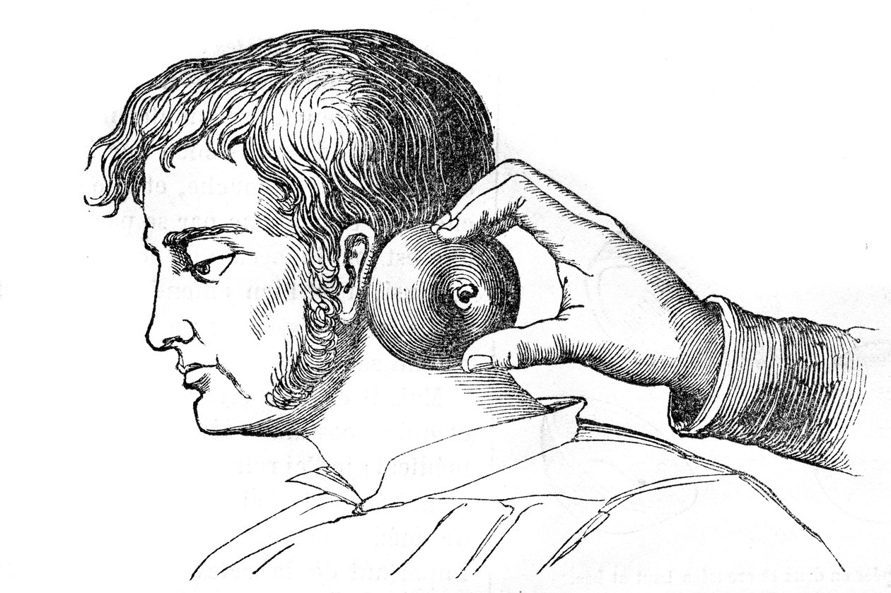 Saignee lokaler - applicering av iglar med ett äpple - gravyr i "La Santo Universelle - Medicinsk guide för familjer"" 1852 av Unknown artist