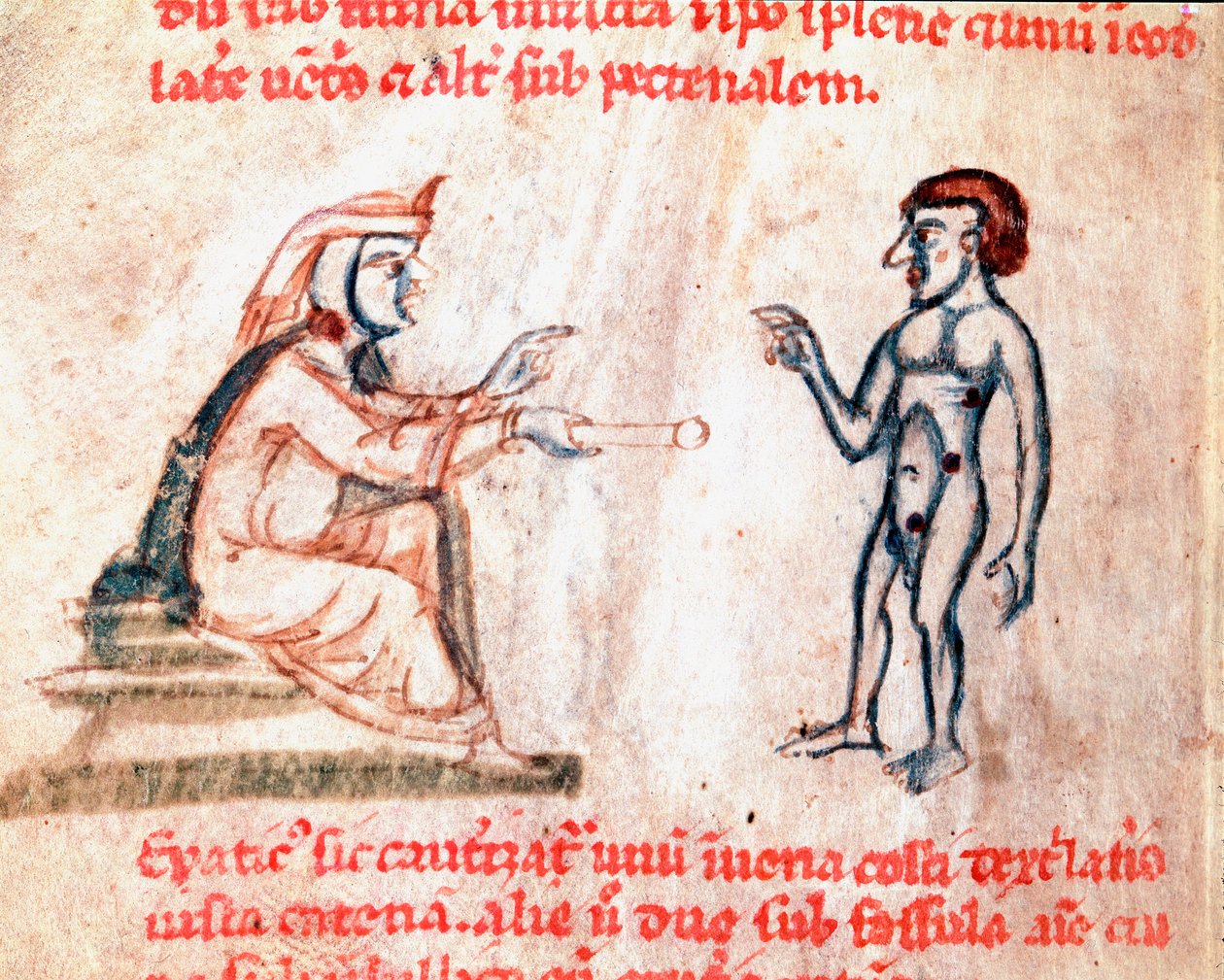 Läkaren bränner patienten på smärtsamma områden med heta strykjärn Miniatyr från manuskriptet "De Medicina cauteriorum secundum Brunum, Rugerius et Rolthe" 1200-talets Paris, B.N. av Unknown artist