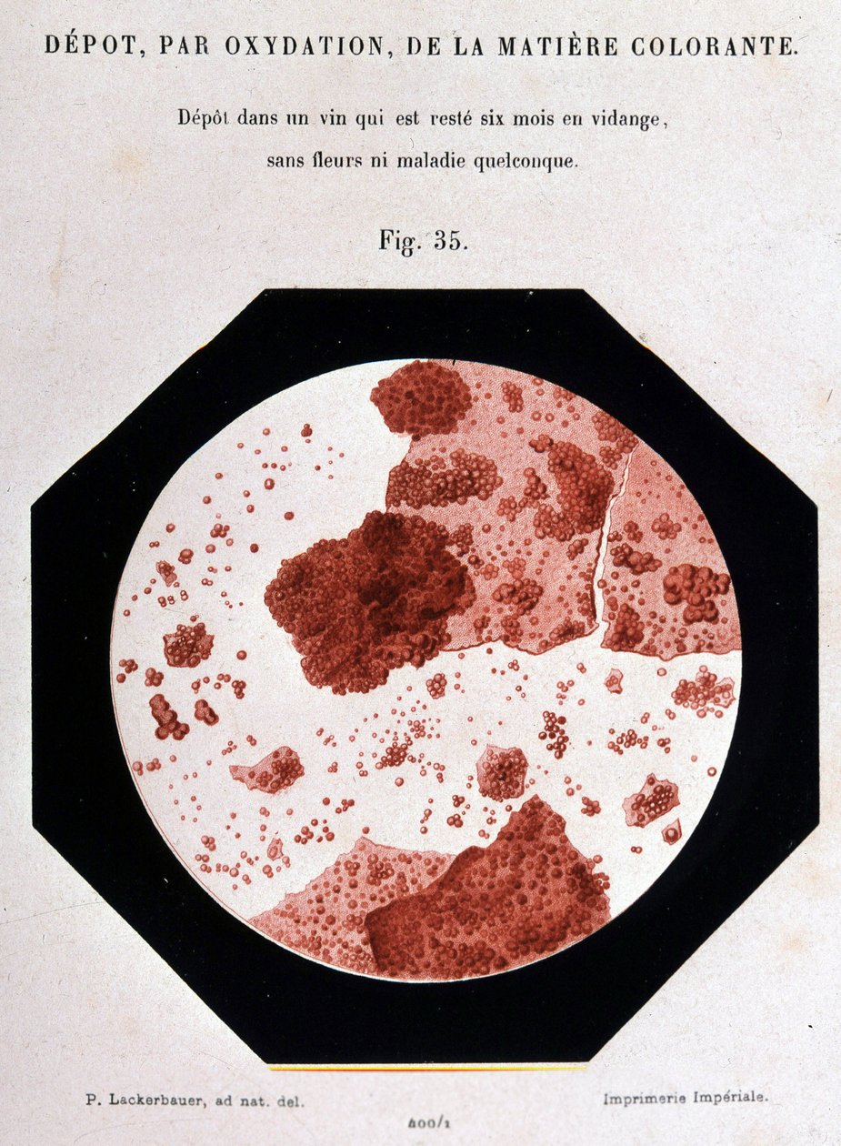 Avsättning, genom oxidation, av färgämnet: avsättning i ett sikte som har varit tömt i sex månader utan blommor eller någon sjukdom. 400/1 mikroskopisk vy. Studie om vin 1866 av Pasteur. av Unknown artist