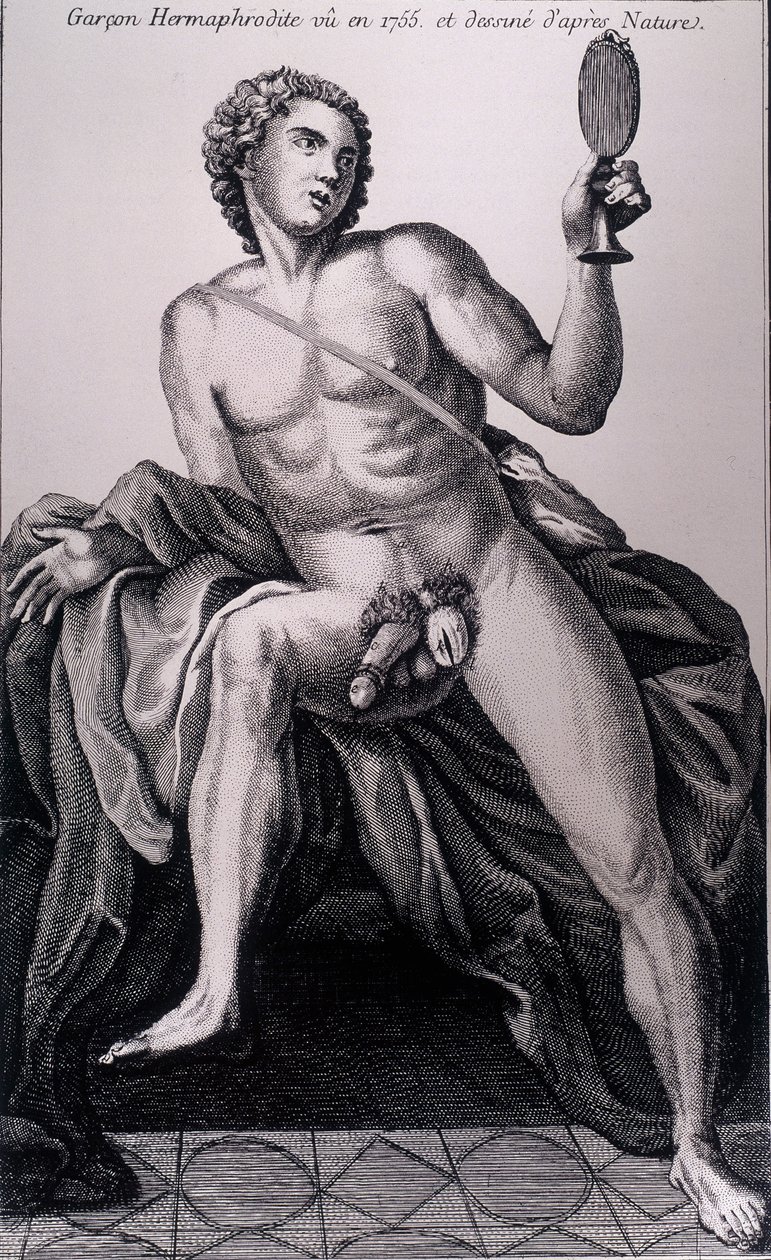 Hermafroditpojke sedd 1755 och hämtad från naturen. av Unknown artist